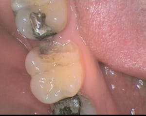 2 b20gss - Eugenol