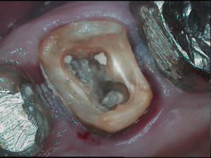 2 barbld - Eugenol