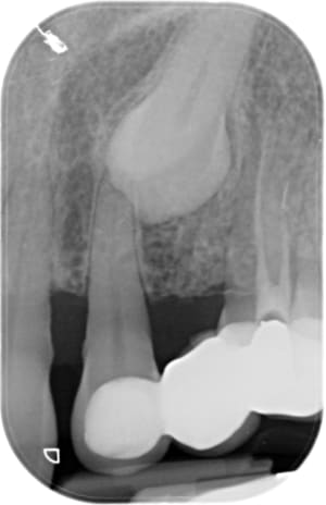 3063 x 20160205 170403 xeqqwaqxj gq 4 urlrjw - Eugenol