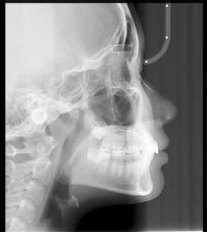 333 kffvzh - Eugenol