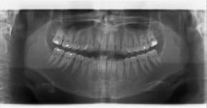 363 20120118 15 32 07 whtfzh - Eugenol
