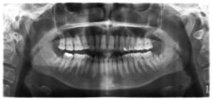 38b bso1yn - Eugenol