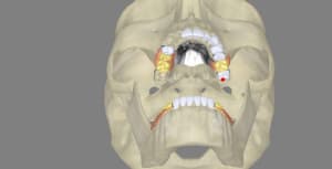 3dscreenshot101 fxi1dp - Eugenol