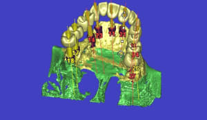 3d15 gvvld7 - Eugenol