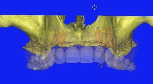 3d2 qjfr3k - Eugenol