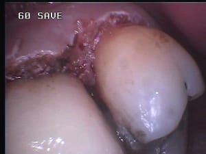 437 lppdri - Eugenol