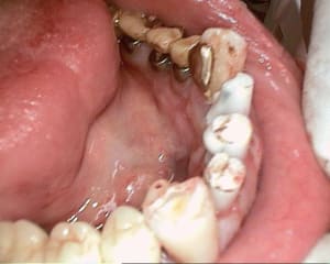44 20120602 103051 zwf1jd - Eugenol