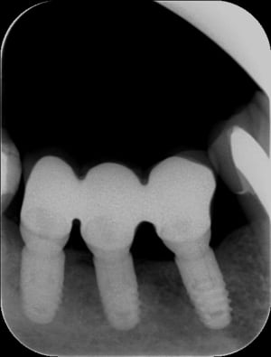 44 45 46 hiivzt - Eugenol