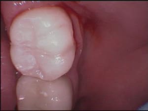 47 ct mo5k9j - Eugenol