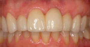 4   large  hhulti - Eugenol
