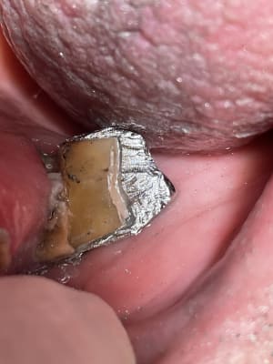 564e4a4f 5fd3 4d5d 9d1a 202a6fc0475c dzxfbo - Eugenol