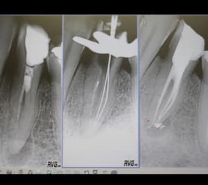 5e63103d feb0 43bb 8de0 c612ce867ed2 a593xo - Eugenol