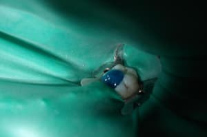 5 m78ydd - Eugenol