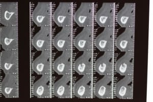 5 rc3lcy - Eugenol