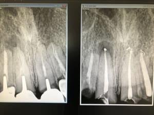 6c2be8c9 d312 4b68 b7a8 cc414ca1ecbd wetrct - Eugenol