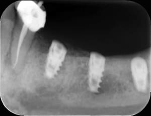 6e7c0ab2 b85c 4ed0 ad0f 959f16c164db zjxwub - Eugenol