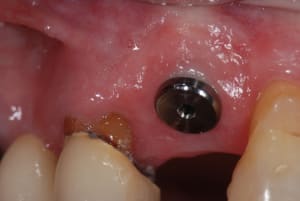 6 mois kx5itc - Eugenol
