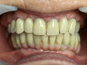 6c1kyiu8eezb3t47t5y86ft7y07y - Eugenol