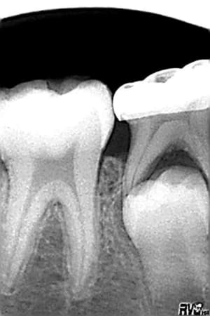 85 cp 2002 lpwyhv - Eugenol