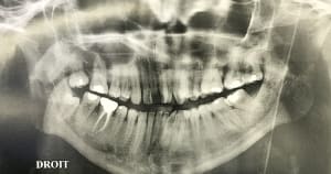 8a95f379 91f2 4729 a1e1 5368cf987903 rdpjrv - Eugenol