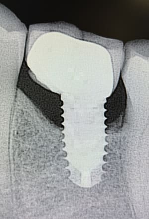 90k85z40xqasalmbfpgfloip5dq3 - Eugenol