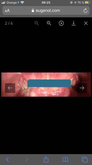 9f6a587a 5f01 412a 89c1 653853899a8a psdr8s - Eugenol