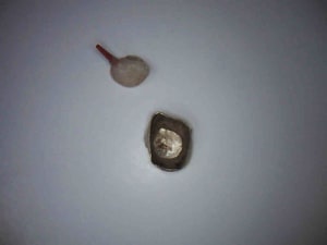 9 oyksu9 - Eugenol