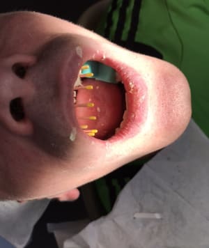 A0097034 6237 4098 8df2 a419df7d5218 myu2rr - Eugenol