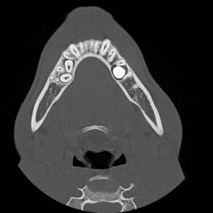 A15 uivdh6 - Eugenol