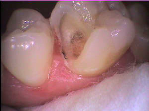 A3 jleh5f - Eugenol