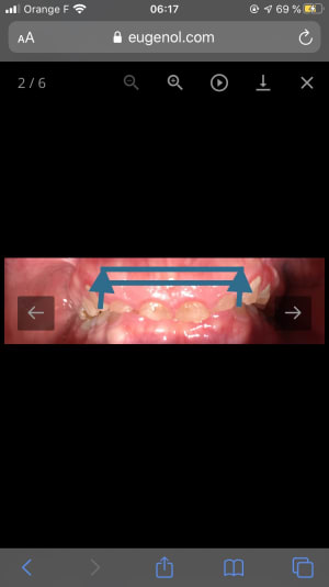 Ad996930 488b 445d bc69 8aaa4493ad61 bspsny - Eugenol