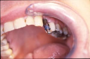 Alexis serge 12 khroyh - Eugenol