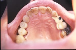 Alexis serge 14 c6v1u2 - Eugenol