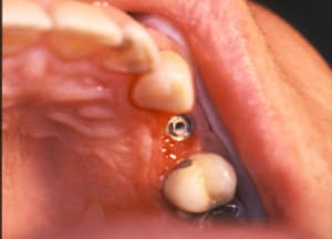 Alexis serge 16 mhfsd6 - Eugenol