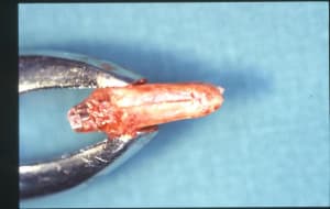 Alexis serge 3 zglzjq - Eugenol