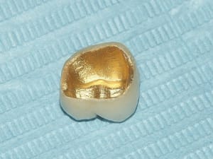 Armature n5oxz1 - Eugenol
