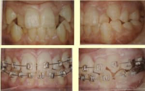 Bk 2 a65zpd - Eugenol