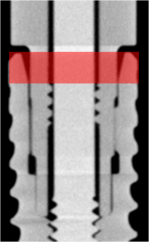 Bone level okj2iz - Eugenol