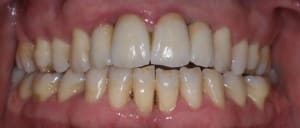 Ccmant ft9nom - Eugenol