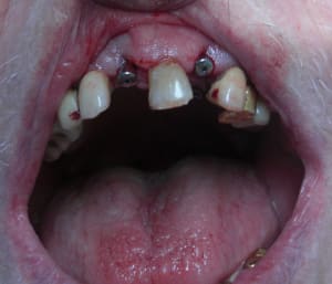 Cimg4538 op5g2z - Eugenol