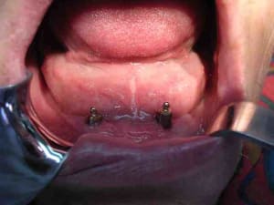 C dscn2999 j8jzjk - Eugenol