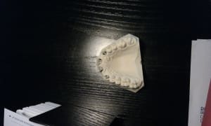 Camerazoom 20120221194729998 ow2zya - Eugenol