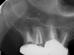 Capteur ou plaque phosphore qifvfv - Eugenol