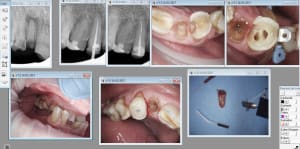 Capture d écran 2017 02 14 21.07 - Eugenol