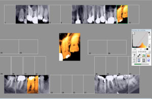 Capture d écran 2017 03 09 15.43 - Eugenol