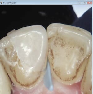 Capture d écran 2017 04 12 18.13 - Eugenol