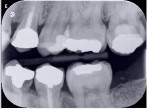 Capture d écran 2018 03 15 15.13 - Eugenol