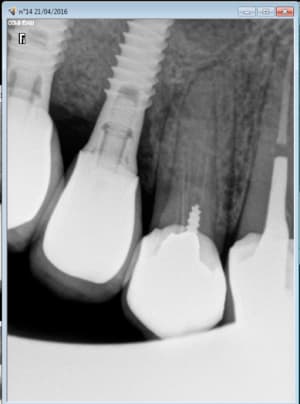 Capture d e cran 2016 04 21 12.12 - Eugenol