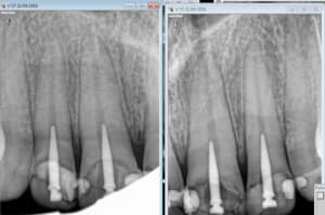 Capture d e cran 2016 04 21 16.54 - Eugenol