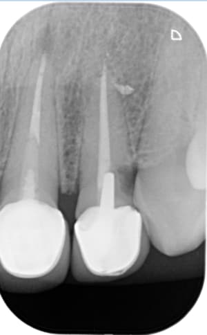 Capture dmgewf - Eugenol